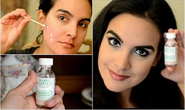 effective Acne Treatment ORIGINAL Mario Badescu Drying Lotion