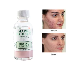 effective Acne Treatment ORIGINAL Mario Badescu Drying Lotion